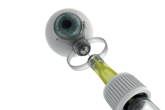 Eye Sp.Eye Innovation