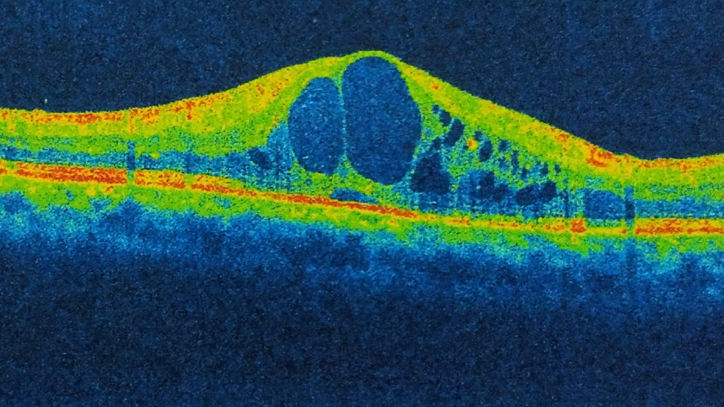 The Ophthalmologist’s Time Machine: Chapter 26