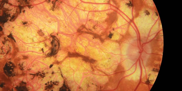 Image of the Month