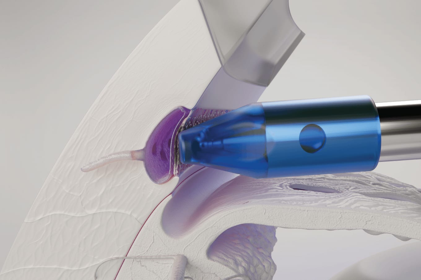 Precision Multiplied