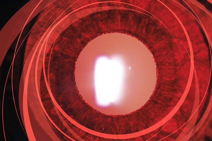 Lighting Up the Slit Lamp