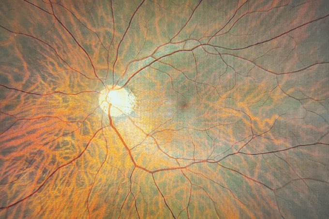 Retinal A to Z… and Other News