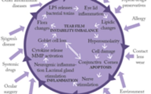Meeting Dry Eye’s Unmet Needs