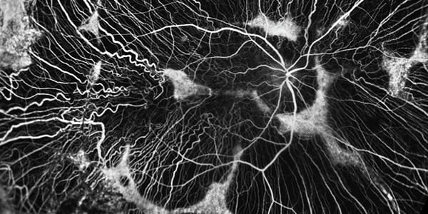 The Art of Eyes: Part 4