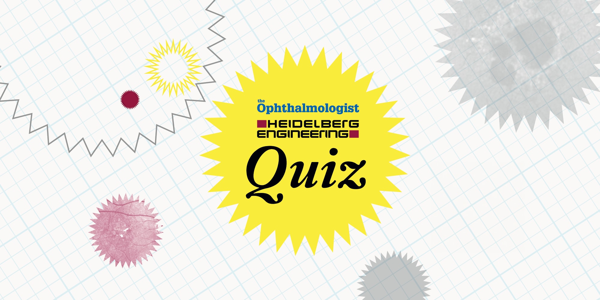 Test Your Diagnostic Skills using OCT and Fundus Imaging