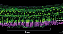 Taking the Heat out of Retinal Laser Therapy