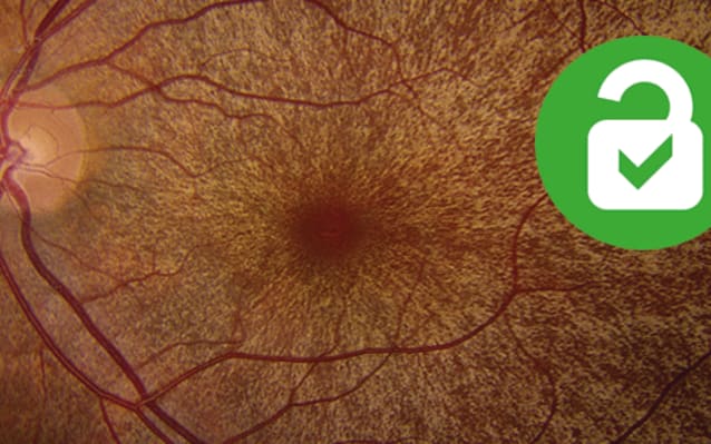 The Art of Eyes: Posterior Segment