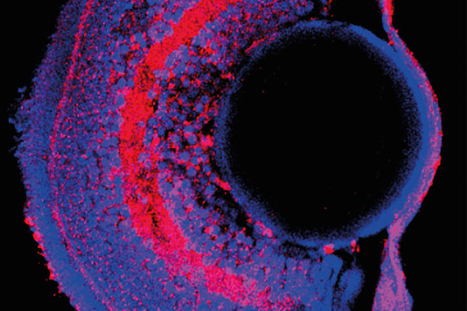 A No-Nonsense Approach to Inherited Disease