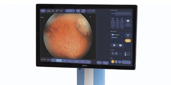 Innovations in Wide-Angle Retinal Imaging