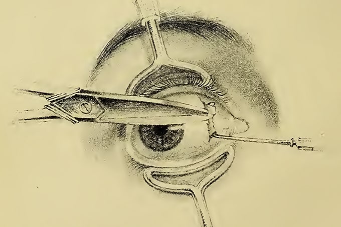 The Ophthalmologist’s Time Machine: Chapter 19