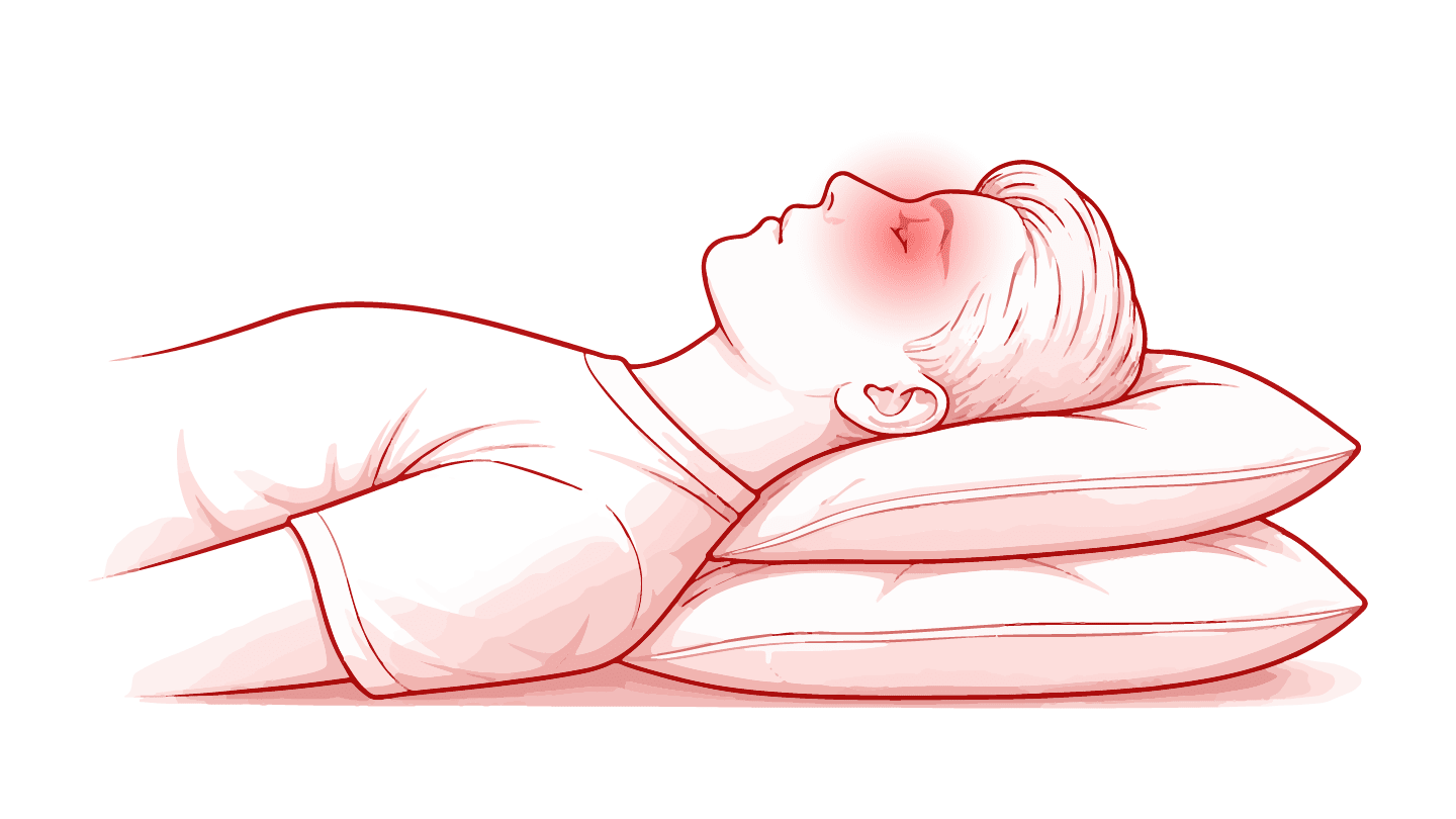 The Pillow Problem in Glaucoma Care