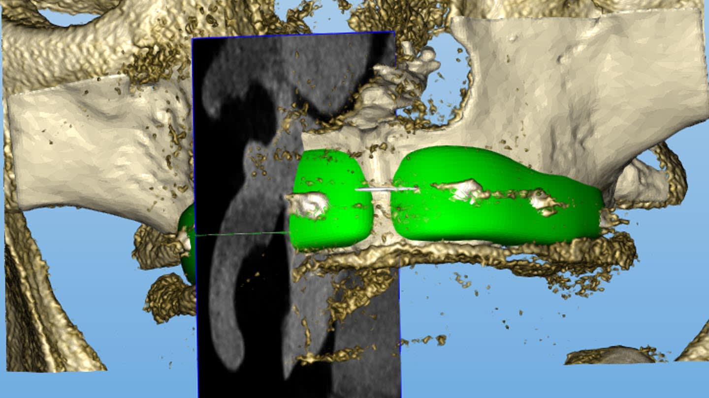 Figure 15