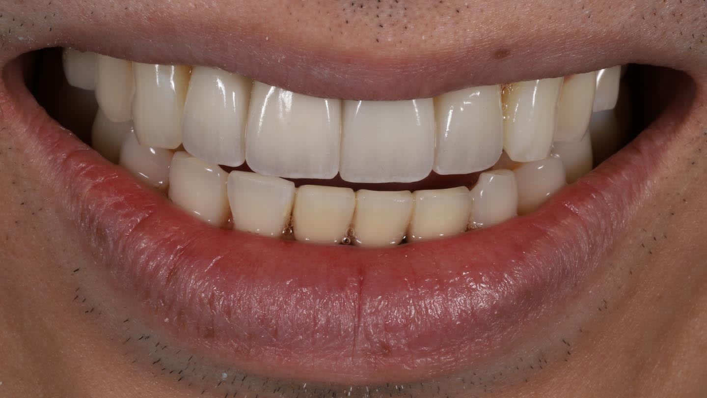 Figure 16