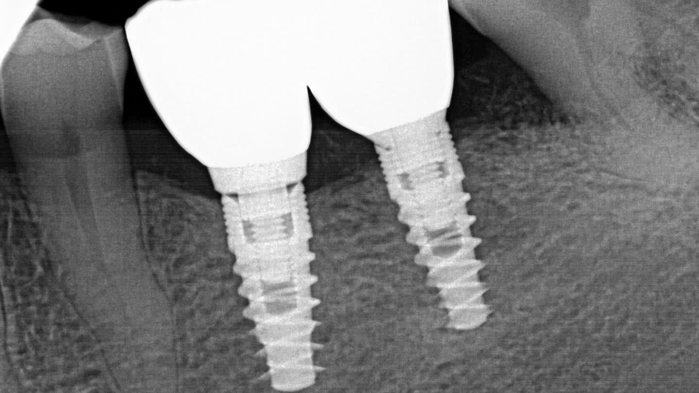 Figure 17