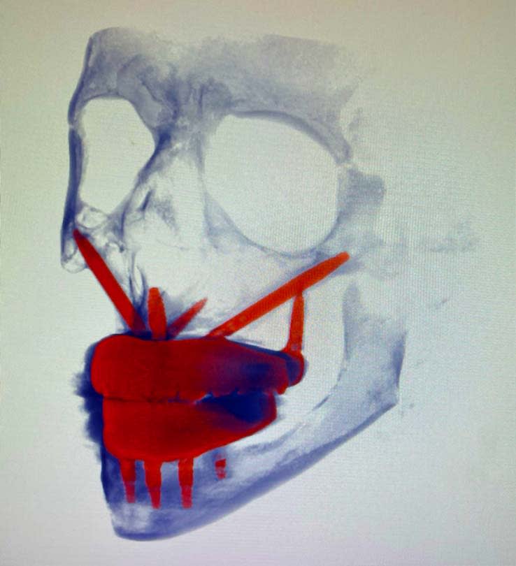 Figure 11
