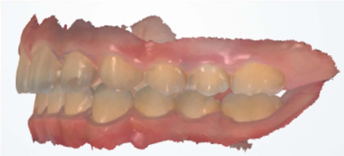 Figure 11