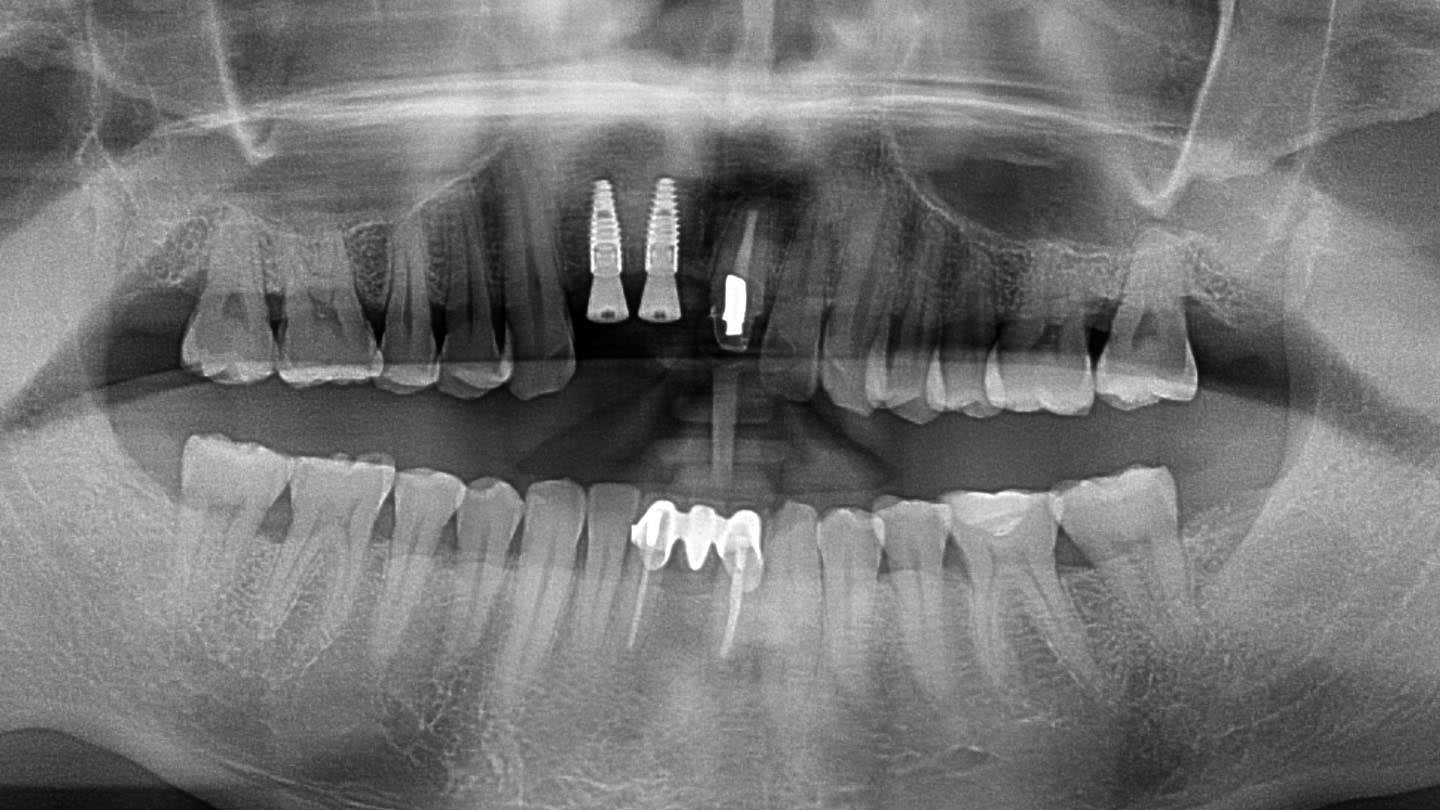 Figure 12