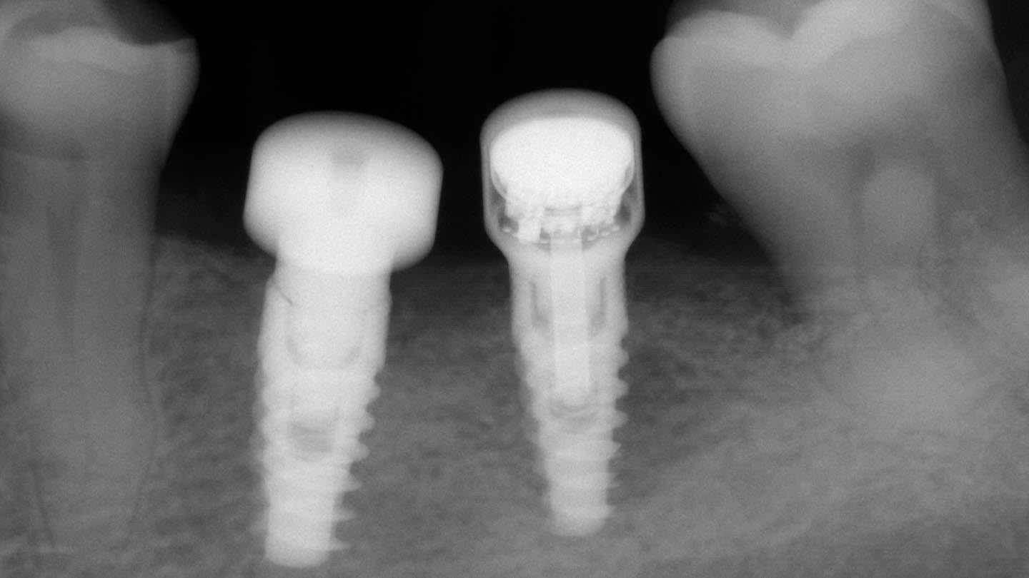 Figure 14