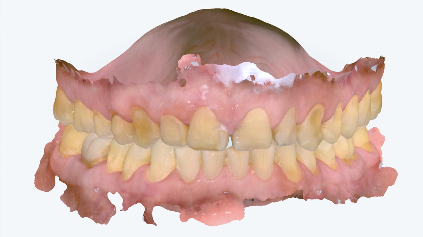 Figure 13