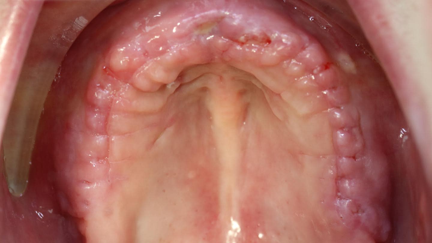 Figure 13