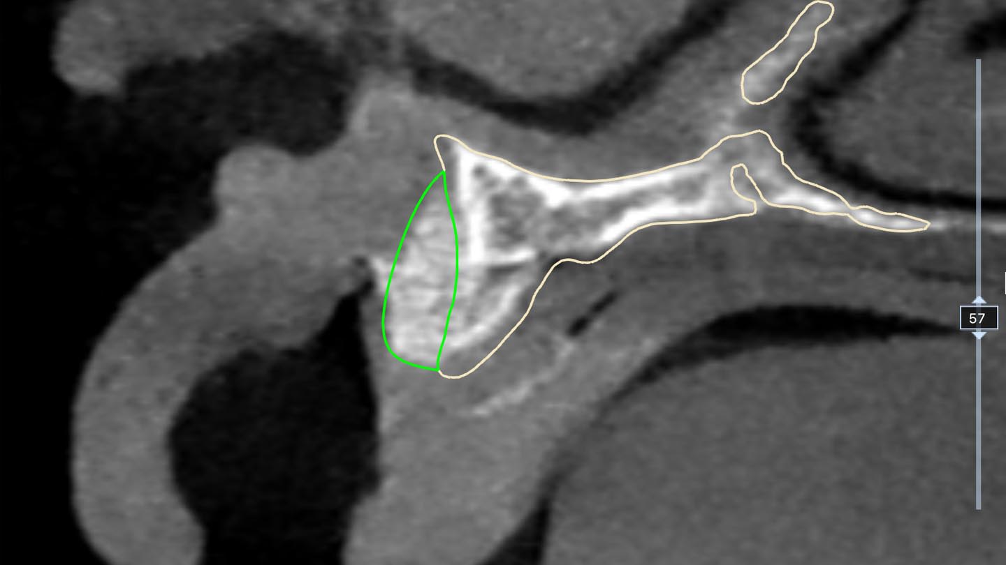 Figure 16