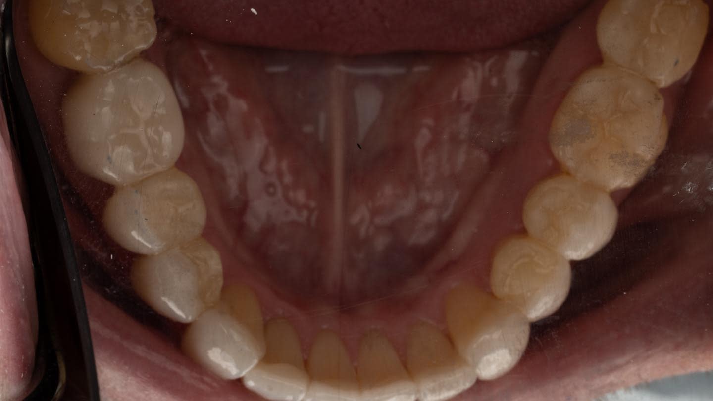 Figure 19