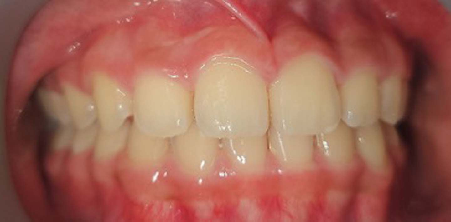Figure 14