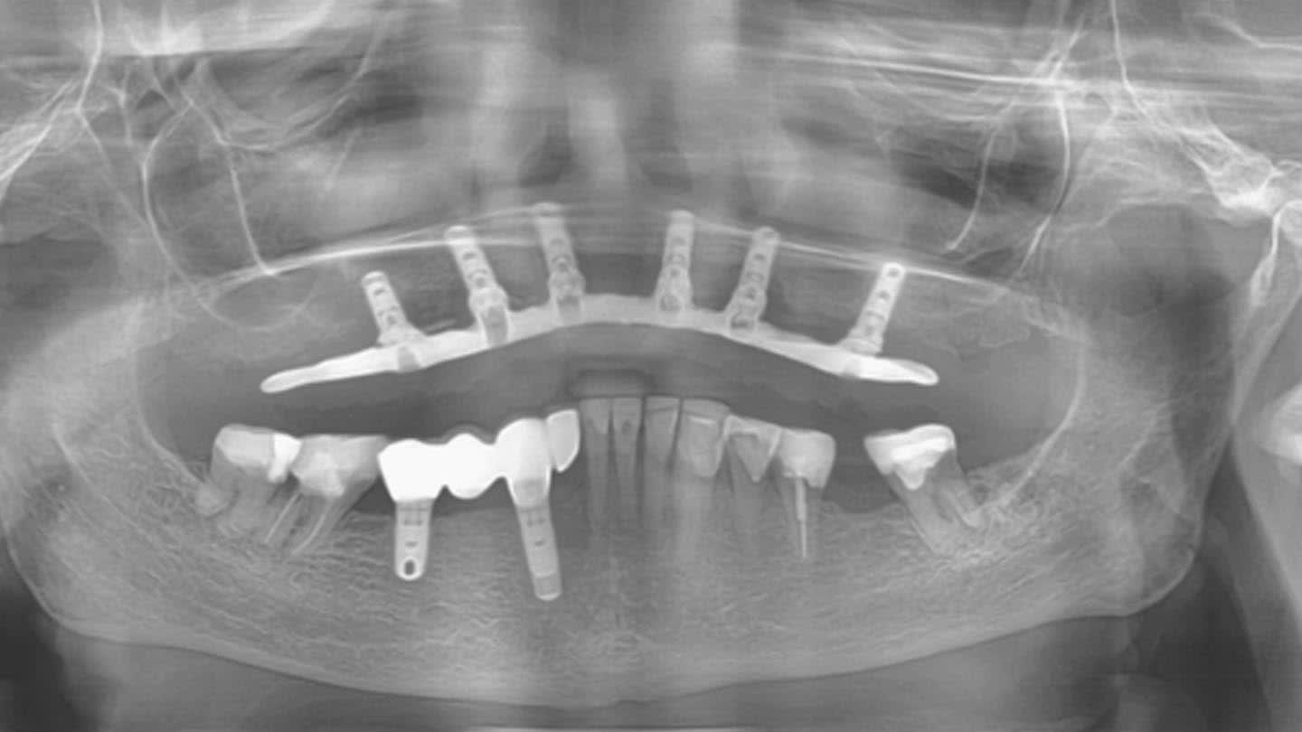 Figure 26