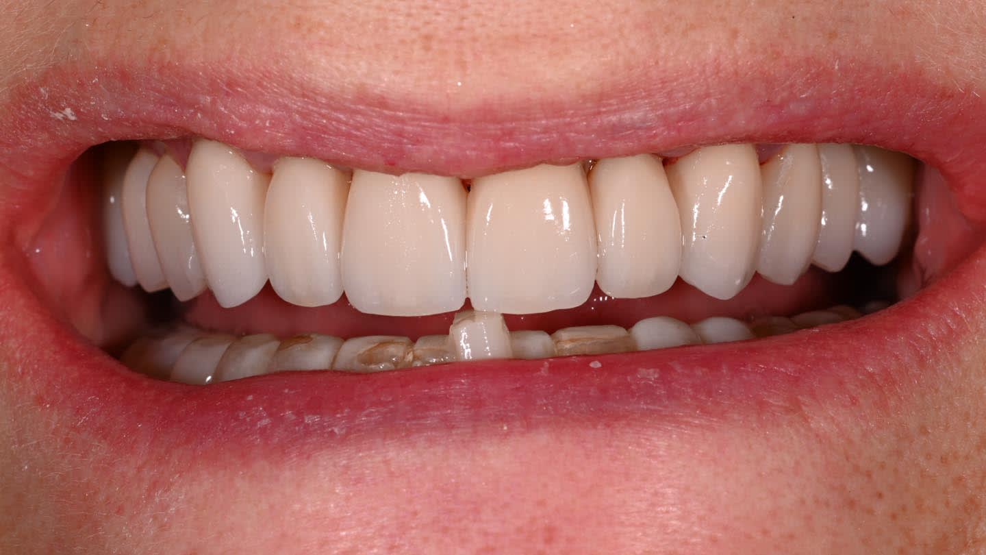 Figure 10