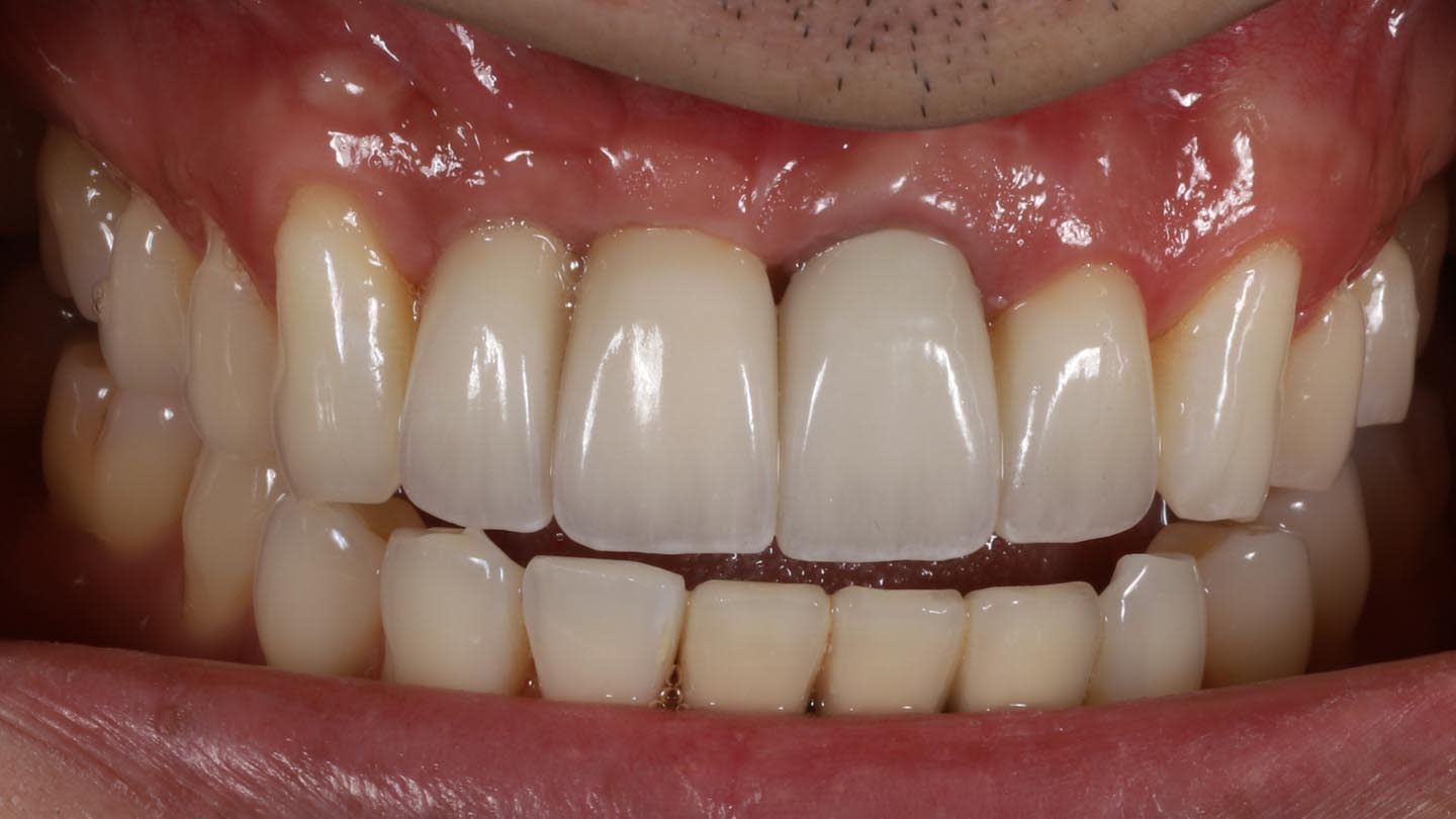 Figure 15