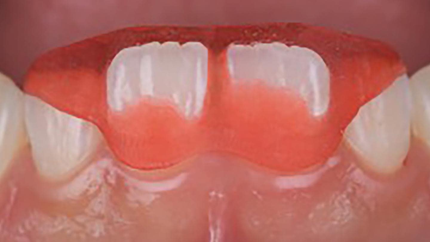 Figure 15