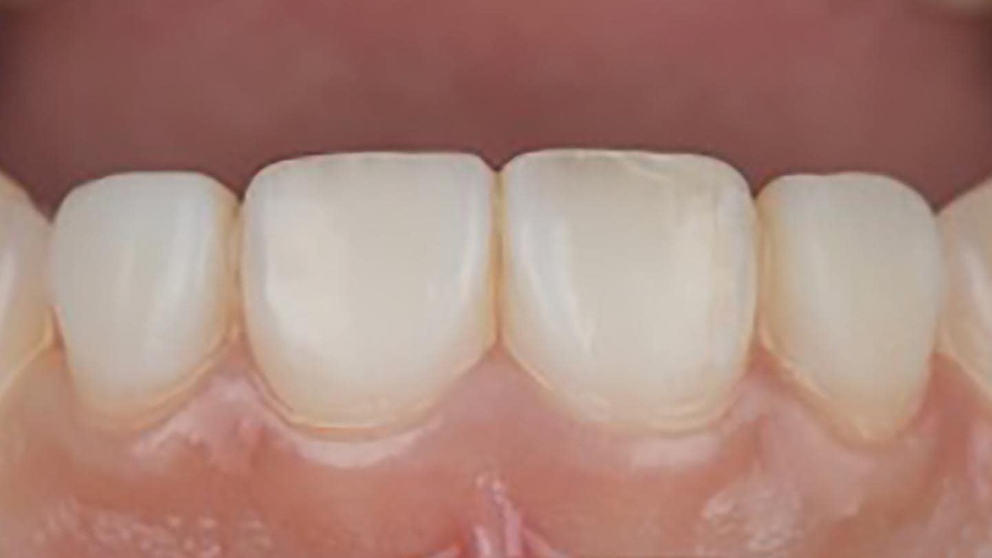 Figure 17