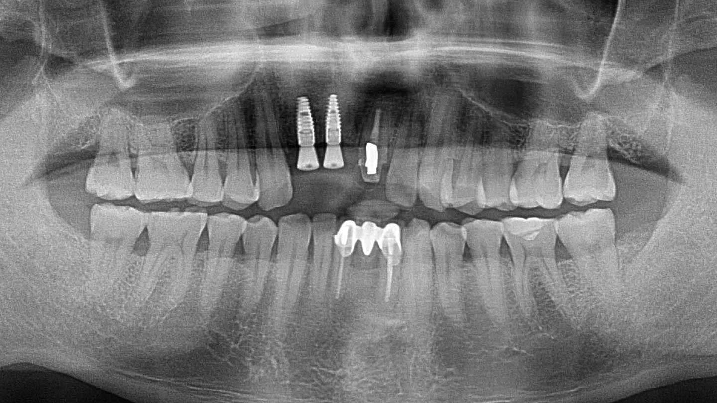 Figure 13