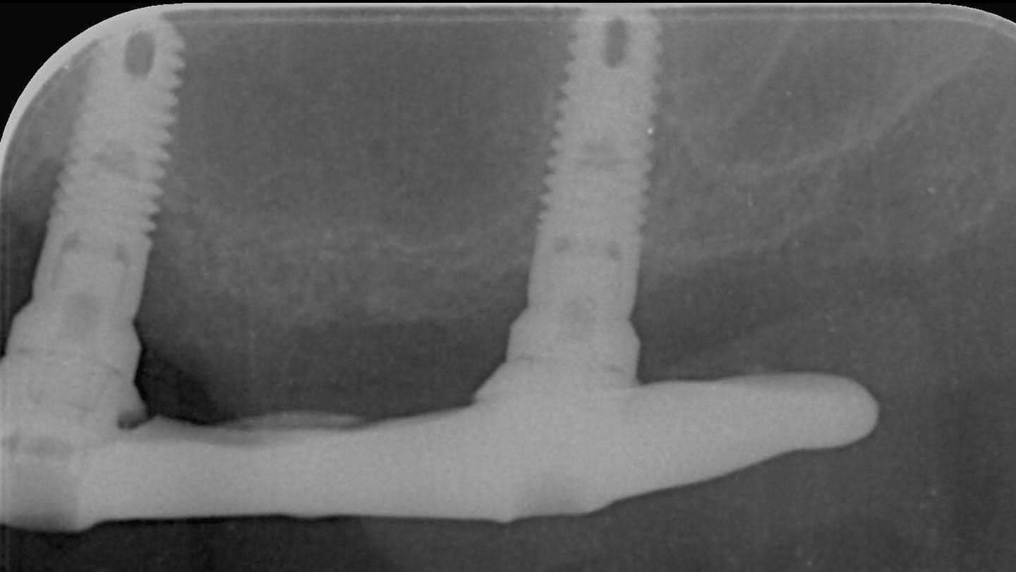 Figure 30