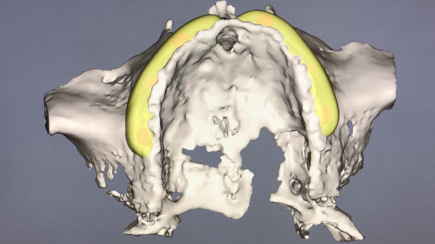Figure 6