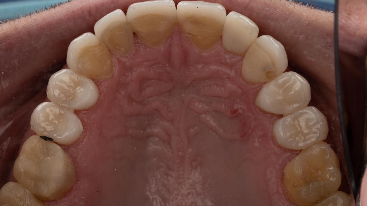 Figure 18