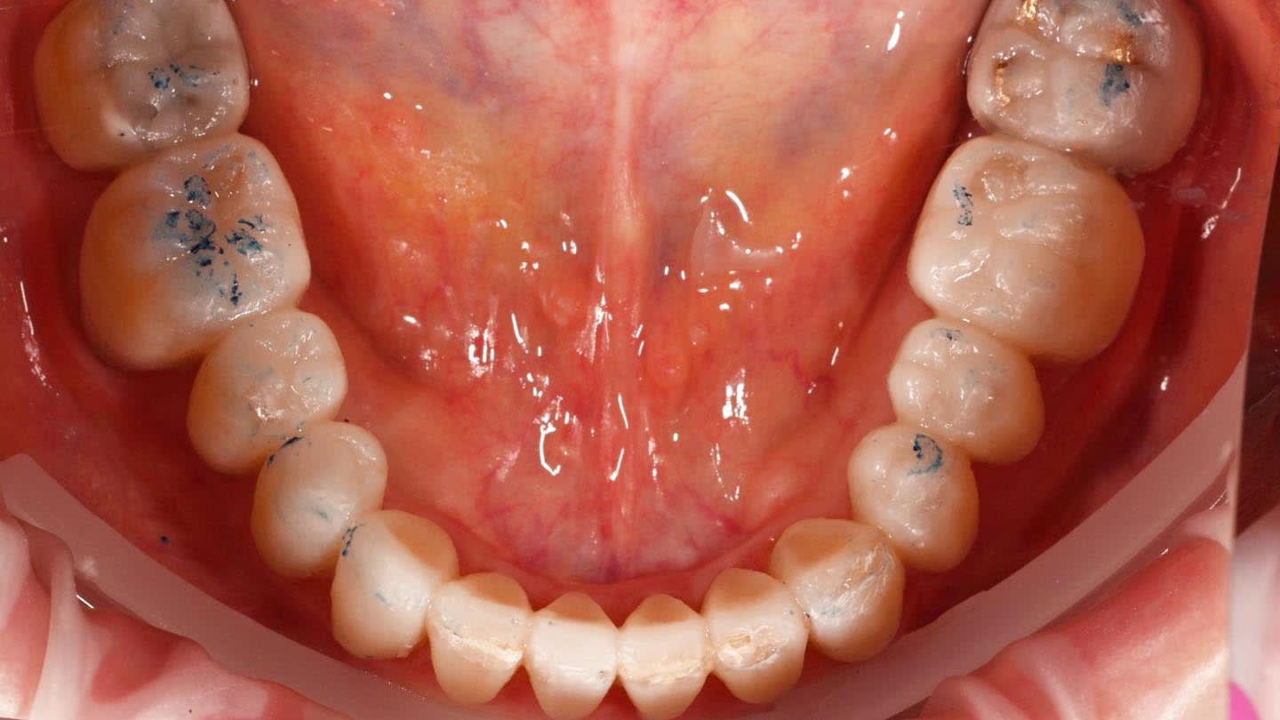 Figure 13