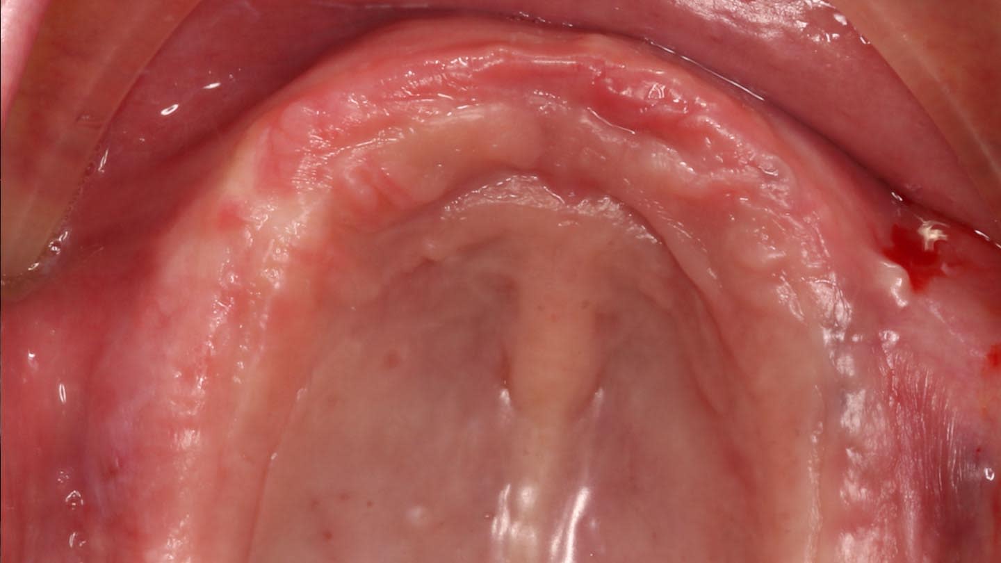 Fig 14