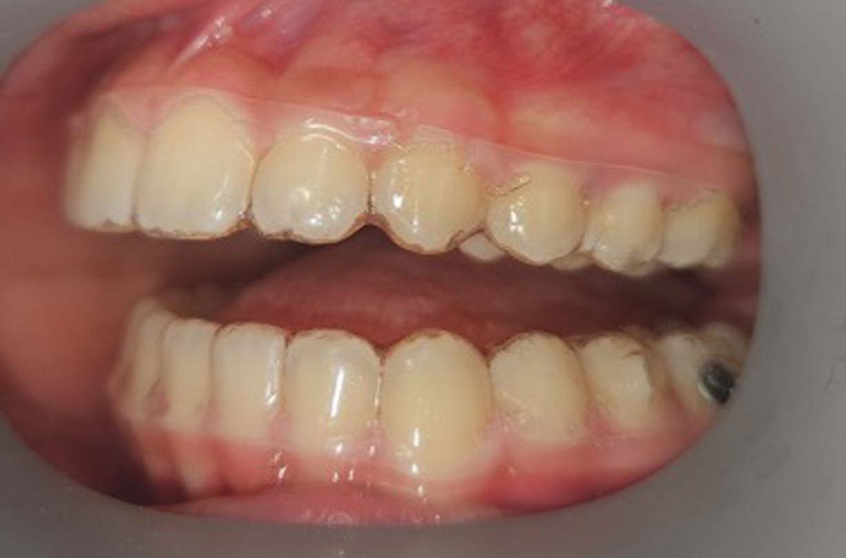 Figure 12