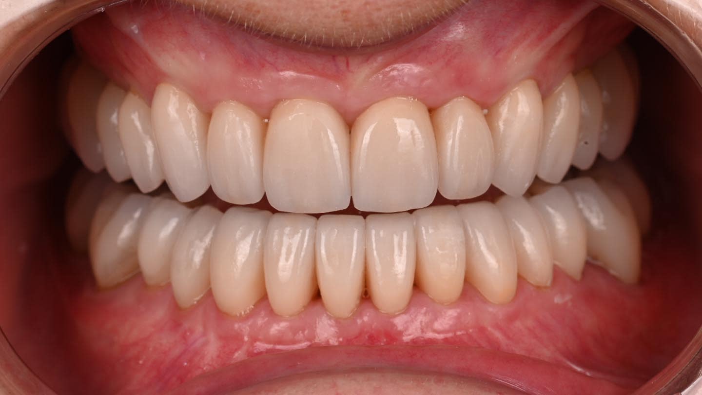 Figure 16