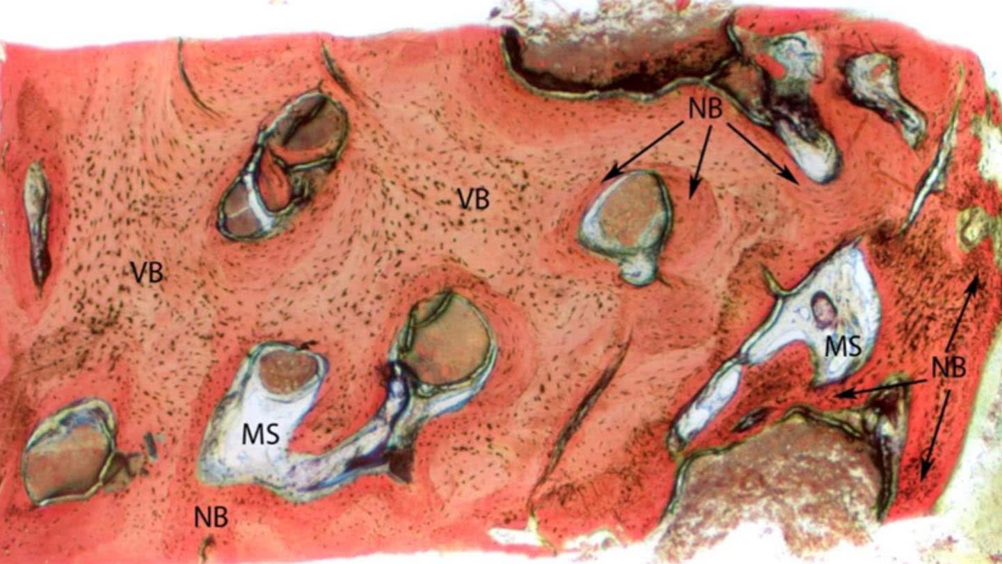 Figure 12