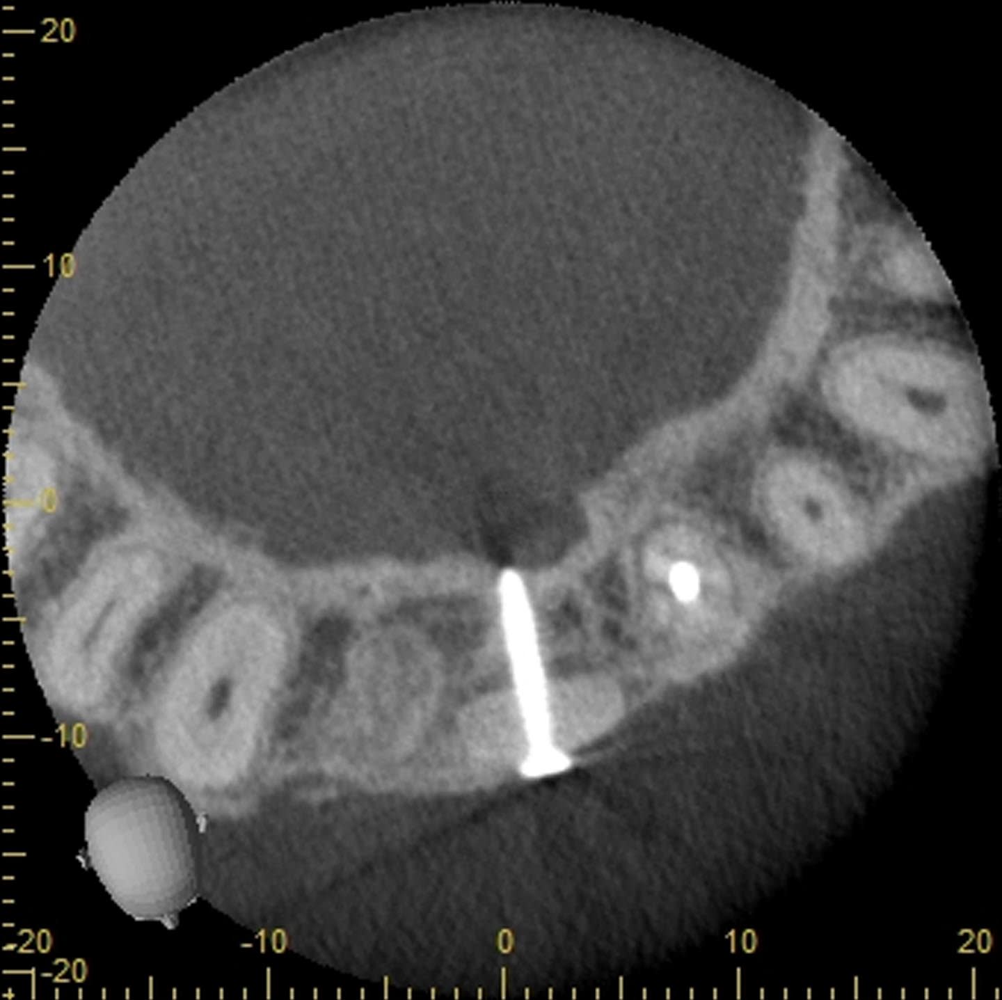 Figure 11