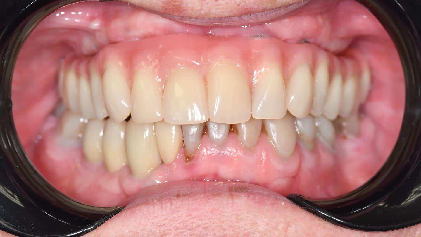 Figure 25