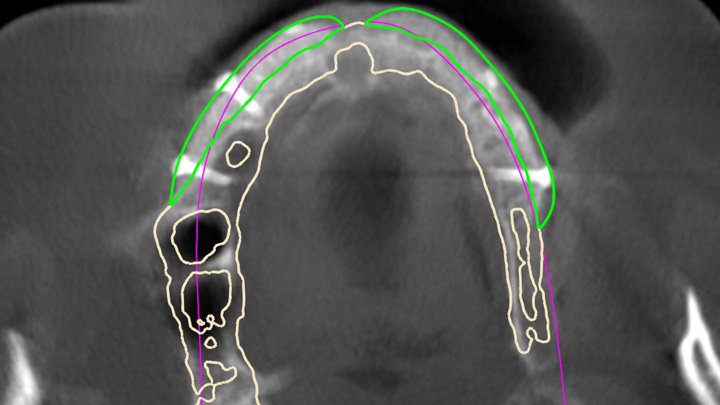 Figure 17