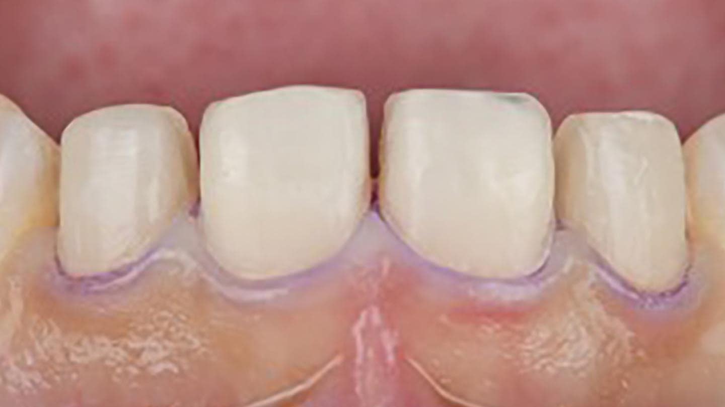 Figure 19