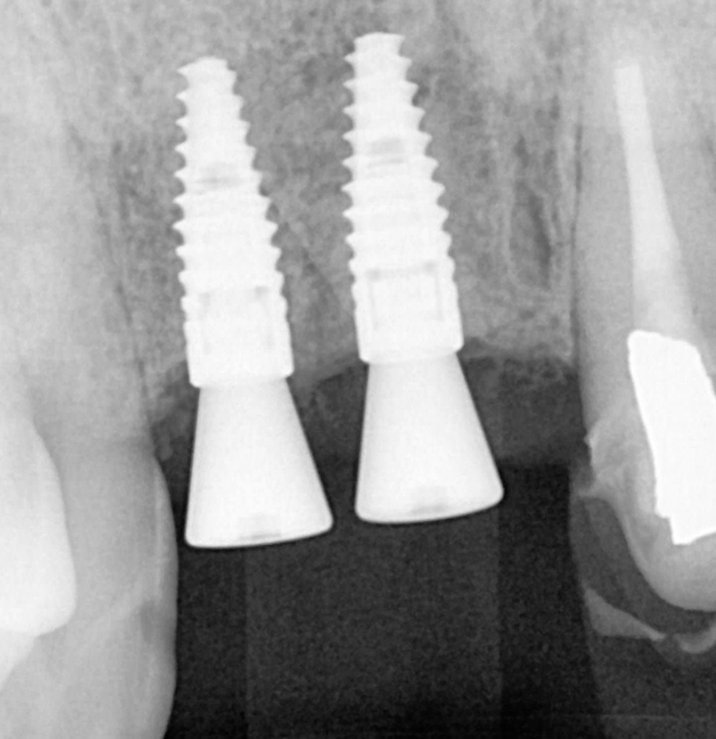 Figure 14