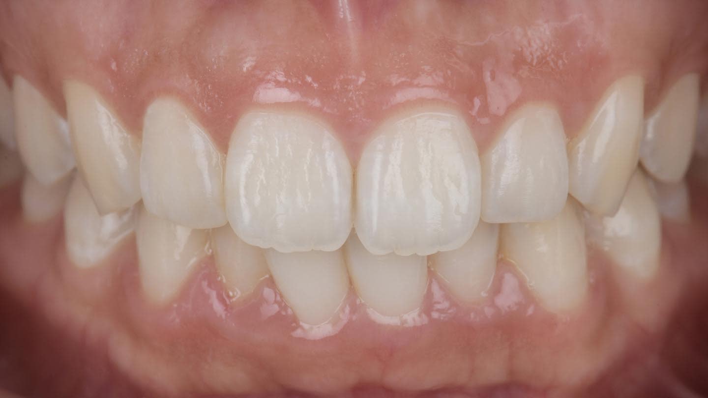 Figure 14