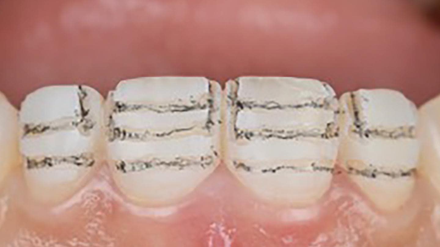 Figure 18