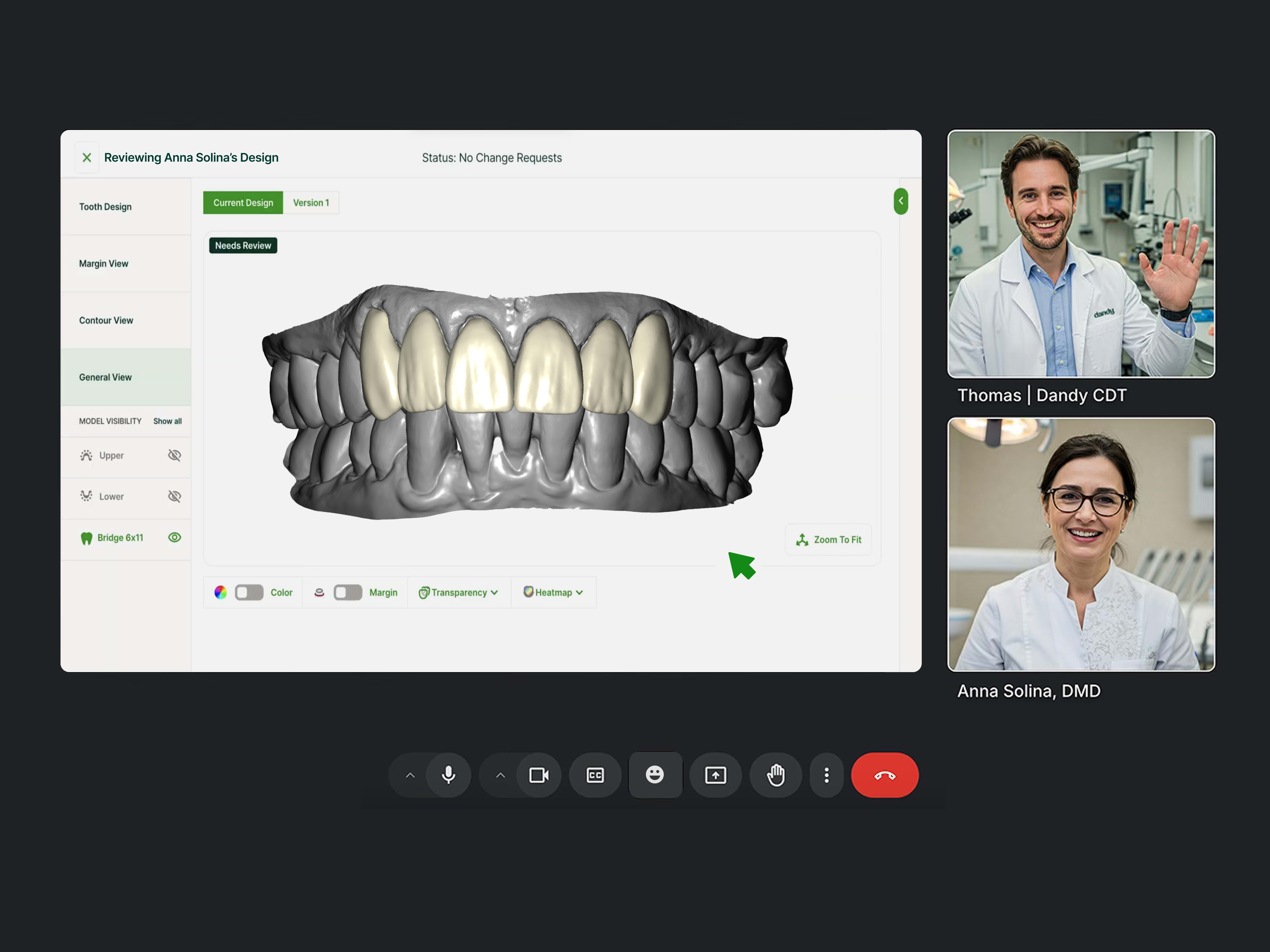 Dentists and technicians can collaborate through Live Design Review for predictable patient outcomes in just a few minutes.