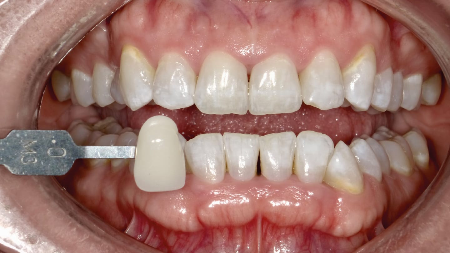 Figure 14
